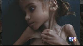 Amal, uccisa dalla fame e dalla guerra thumbnail