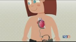 Mini-cuore artificiale salva bimba di 3 anni thumbnail