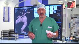 L'aneurisma della aorta thumbnail
