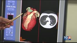 Un unico esame per una diagnosi precoce dei problemi sia di cuore che di polmoni thumbnail
