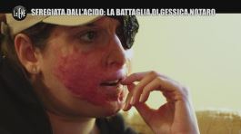 Gessica Notaro, l'ex che l'ha sfregiata con l'acido "voleva cancellarle l'identità" thumbnail