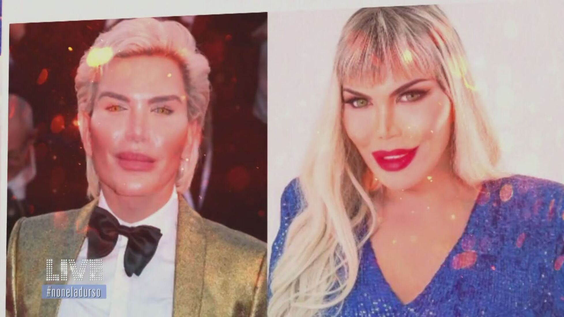 Live Non e la d Urso Rodrigo Alves il Ken umano e diventato Barbie Video Mediaset Infinity