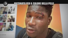 MARTINELLI: Senegalese aggredito a Palermo: "Sono un nero, ma non una merda" thumbnail