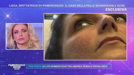 Lidia, spettatrice di Pomeriggio5: il caso della pelle segnata dall'acne thumbnail