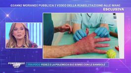 Gianni Morandi inizia la riabilitazione thumbnail