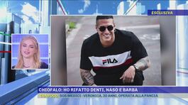 Chiofalo: Ho rifatto denti, naso e barba thumbnail