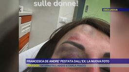 Francesca De Andrè pestata dall'ex: la nuova foto thumbnail