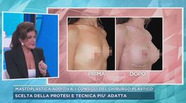Mastoplastica additiva, i conigli del chirurgo plastico thumbnail