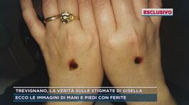 Trevignano, la verità sulle stigmate di Gisella thumbnail