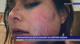 Roma, massacrata di botte davanti al portone di casa thumbnail