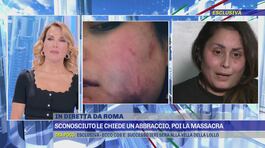 L'intervista a Laura, la giovane donna massacrata di botte da uno sconosciuto a Roma thumbnail