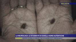 La neurologa: le stigmate di Gisella sono autentiche thumbnail