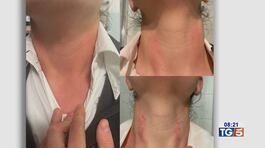 Botte in ospedale, dottoresse nel mirino thumbnail