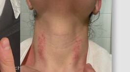 Quasi strangolata in guardia medica thumbnail