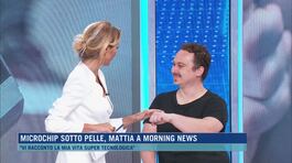 Microchip sotto pelle, la scelta di Mattia thumbnail