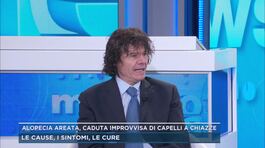 Alopecia areata, caduta improvvisa di capelli a chiazze thumbnail