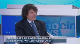 Psoriasi, cos'è, chi colpisce e come si cura thumbnail