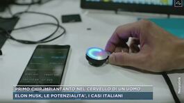 Primo chip impiantato nel cervello di un uomo thumbnail