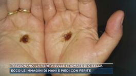 Trevignano, la verità sulle stigmate di Gisella thumbnail