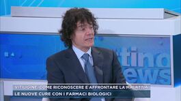 Vitiligine, come riconoscere e affrontare la malattia thumbnail