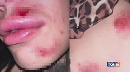 Due amiche transgender aggredite dal branco thumbnail