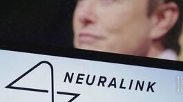 Un microchip nel cervello umano thumbnail
