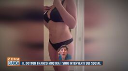 Il dottor Franco mostra i suoi interventi sui social thumbnail