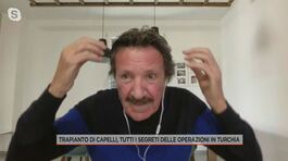 Trapianti di capelli, parla Cesare Ragazzi thumbnail