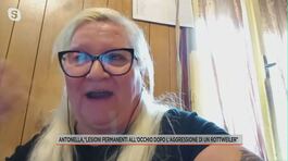 Antonella, "Mi sono sottoposta a 27 interventi dopo l'aggressione di un cane" thumbnail