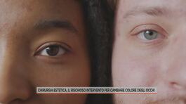 Chirurgia estetica, il rischioso intervento per cambiare colore degli occhi thumbnail