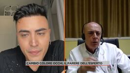 Cambio colore occhi, il parere dell'esperto thumbnail