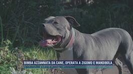 Bimba azzannata da cane, operata a zigomo e mandibola thumbnail
