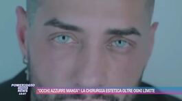 "Occhi azzurri mania": la chirurgia estetica oltre ogni limite thumbnail