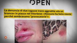 Il branco aggredisce due trans thumbnail