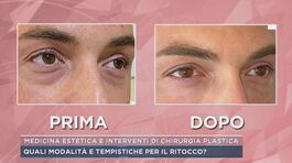 Medicina estetica e interventi di chirurgia plastica thumbnail