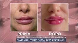 Bellezza e benessere fisico, un approccio integrato thumbnail