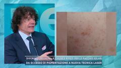 Discromie della pelle, cause e rimedi per le macchie solari