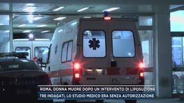 Roma, donna muore dopo un intervento di liposuzione thumbnail