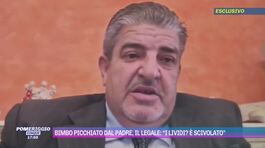 Bimbo picchiato dal padre, il legale: "I lividi? È scivolato" thumbnail