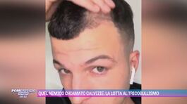 Quel nemico chiamato calvizie: la lotta al tricobullismo thumbnail