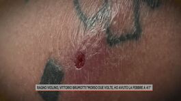 Ragno violino, Vittorio Brumotti morso due volte thumbnail