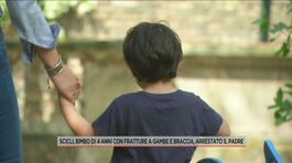 Scicli, bimbo di 4 anni con fratture a gambe e braccia, arrestato il padre thumbnail