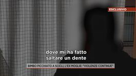 Bimbo picchiato a Scicli, l'ex moglie: "Violenze continue" thumbnail