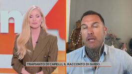 Trapianto di capelli, il racconto di Guido thumbnail