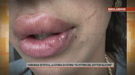 Corpi deturpati e visi sfigurati, quando la chirurgia estetica rovina la vita thumbnail