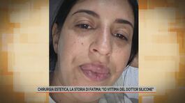 Chirurgia estetica, la storia di Fatima: "Io vittima del Dottor silicone" thumbnail