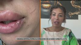 Chirurgia estetica, Fatima e le operazioni che le hanno cambiato la vita thumbnail