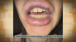Chirurgia estetica, la storia di Veronica "Vittima del dottor silicone" thumbnail