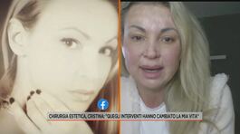 Chirurgia estetica, Cristina: "Quegli interventi hanno cambiato la mia vita" thumbnail
