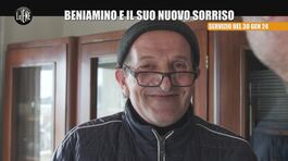 BARRACO: Beniamino e il suo nuovo sorriso thumbnail